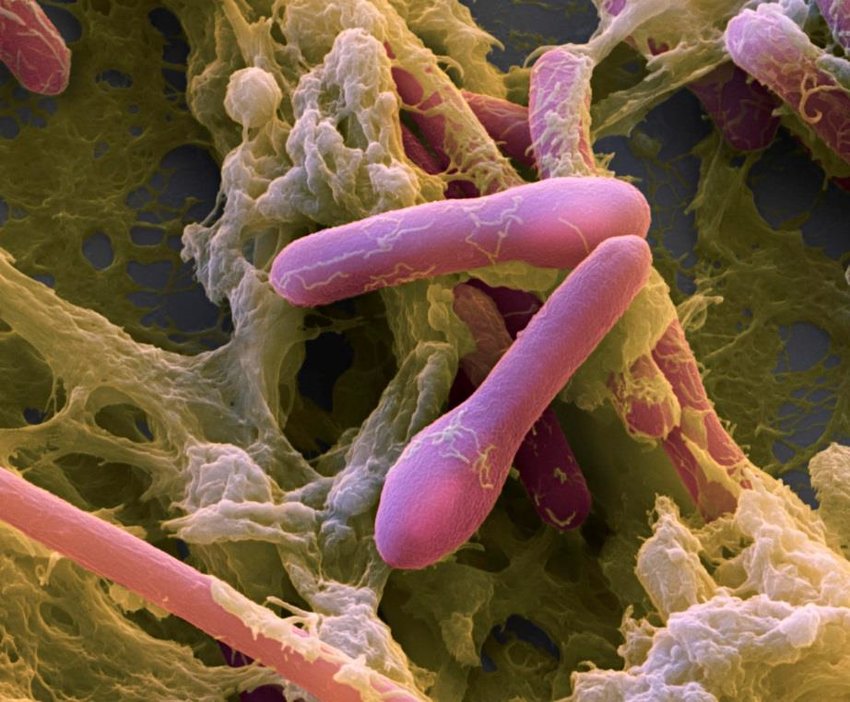 Description: https://www.kiyoi.com/wp-content/uploads/2019/12/Clostridium-botulinum-bacteria-150x150.jpg
