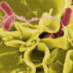 Description: https://www.kiyoi.com/wp-content/uploads/2019/12/Salmonella-typhi-bacteria-150x150.jpg